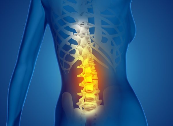 3D render of a female medical figure with spine highlighted