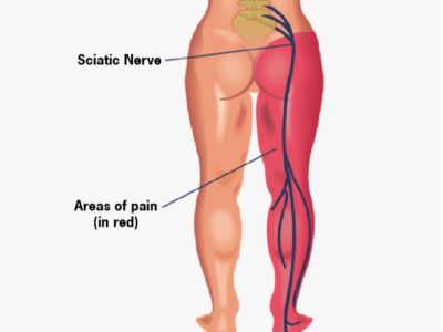 860b7d_cc762a3a8ac6439aa6b3947e391abc6a~mv2